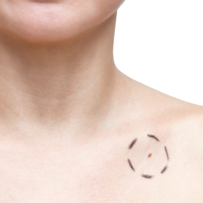 Moles