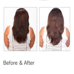 new-Hair-loss
