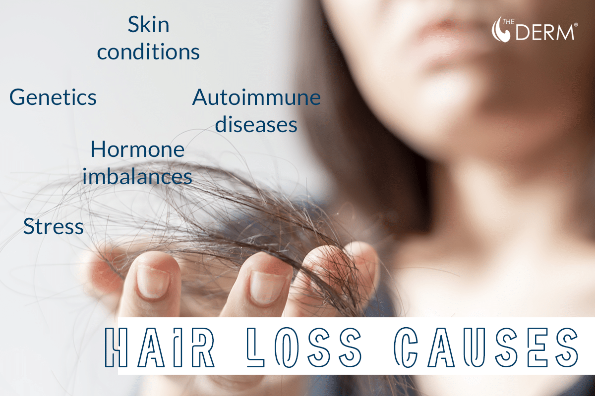 hair loss causes hair loss causes