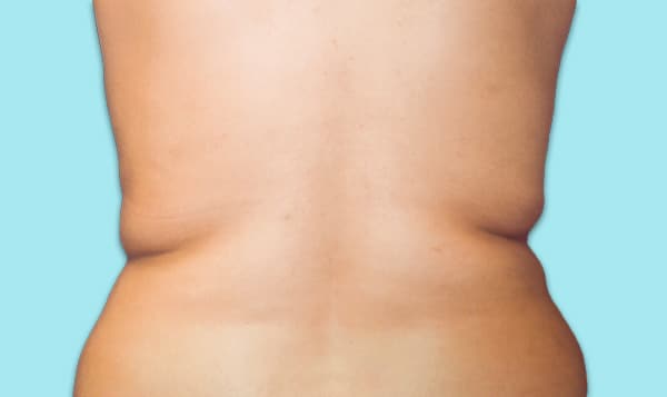 Back-Before
