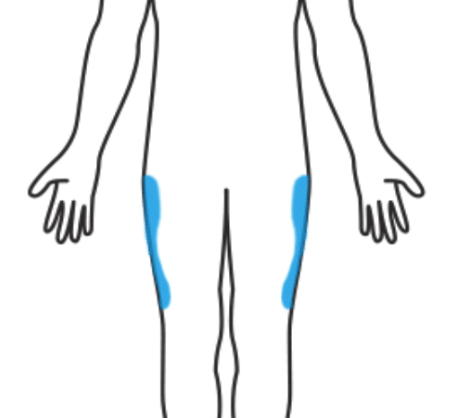 Outer Thighs