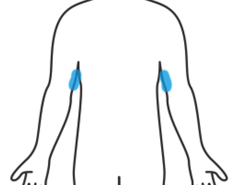 Upper Arms