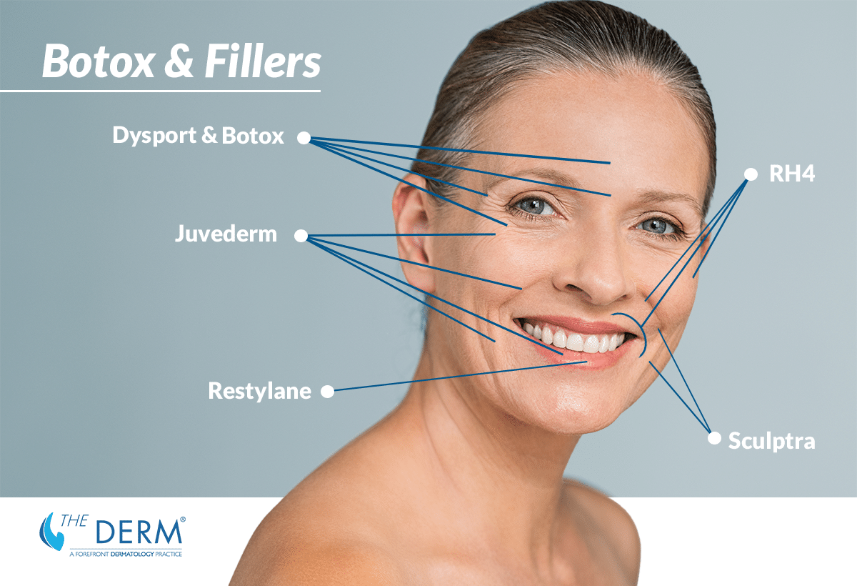botox and fillers botox and fillers