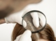 hair loss