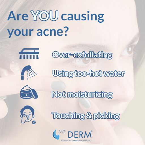 acne causes acne causes