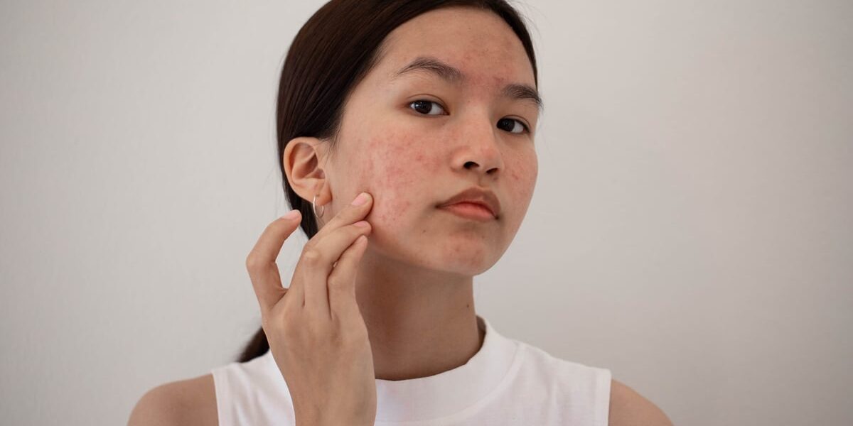Cropped shot of a young woman squeezing a pimple on her face
