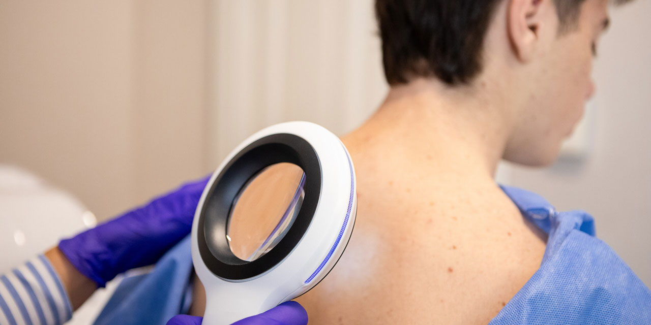 Dermatologist examining her patient with a dermatological magnifying glass