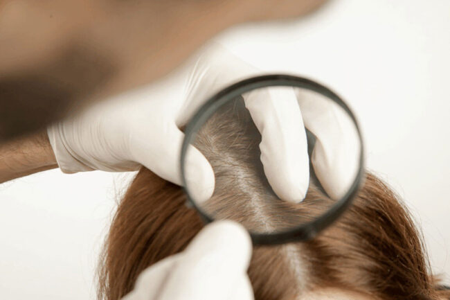From Hair Loss to Hair Removal